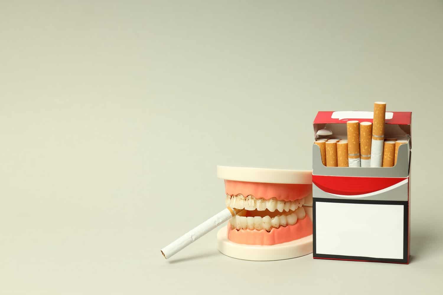 Smoke Teeth: An Underestimated Health Risk