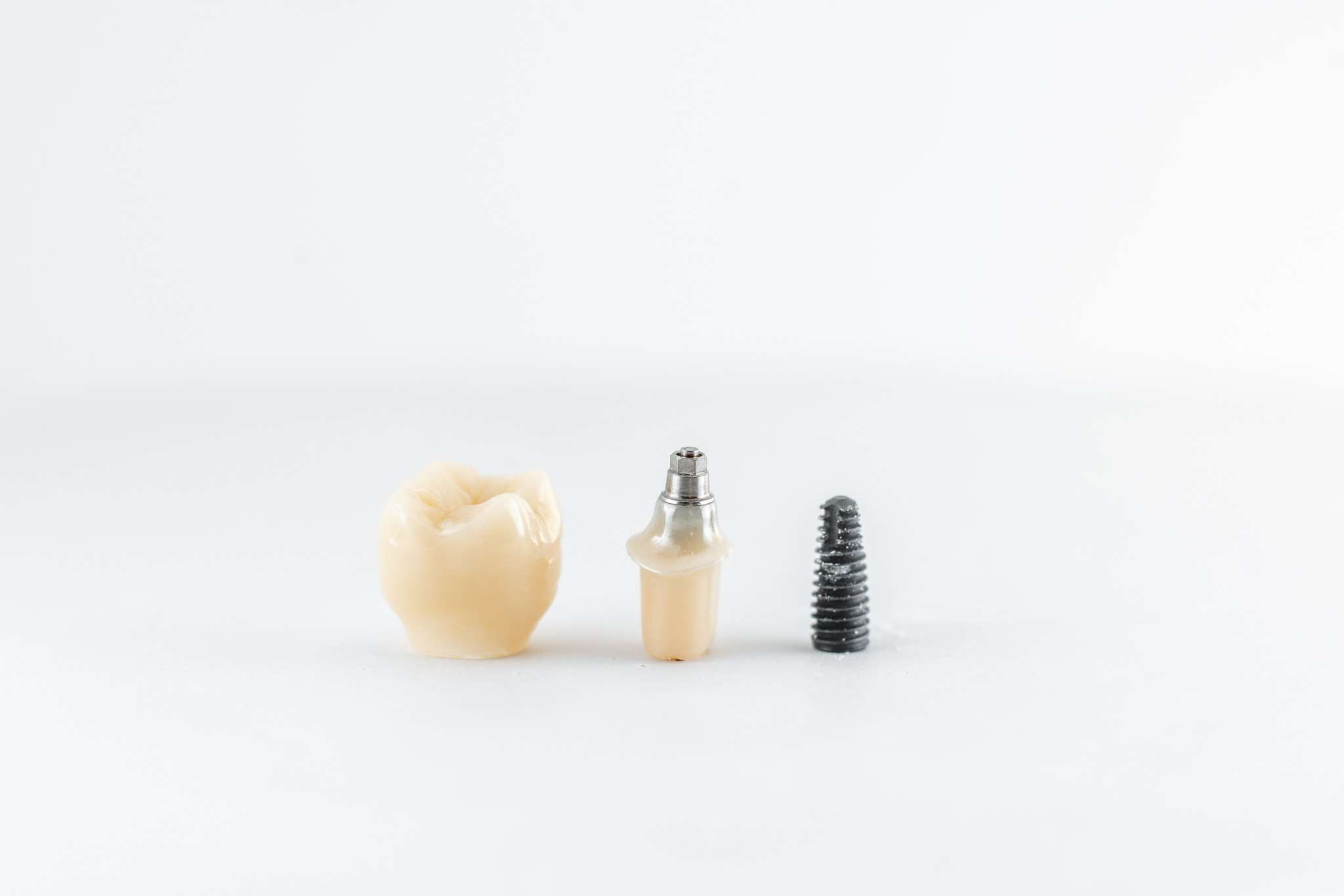 Types of Dental Implants Materials - Overview and Comparison