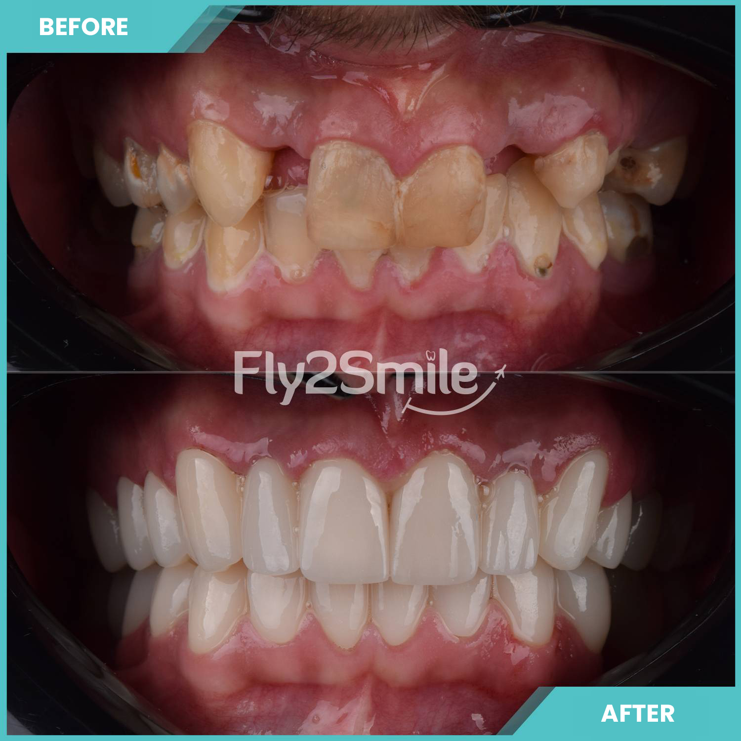 crowns-turkey-resultat